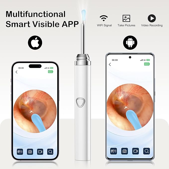 Ear Wax Removal Tool Camera，Wireless Ear Cleaner with Camera 1080P, Earwax Removal Kit with 6 LED Light 5 Replacement Ear Spoon, Ear Camera for iOS & Android (White)