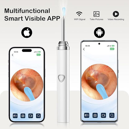 Ear Wax Removal Tool Camera，Wireless Ear Cleaner with Camera 1080P, Earwax Removal Kit with 6 LED Light 5 Replacement Ear Spoon, Ear Camera for iOS & Android (White)